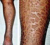 skin conditions